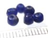 Picture of ANCIENT ROMAN  GLASS BEADS. 1700 + YEARS OLD